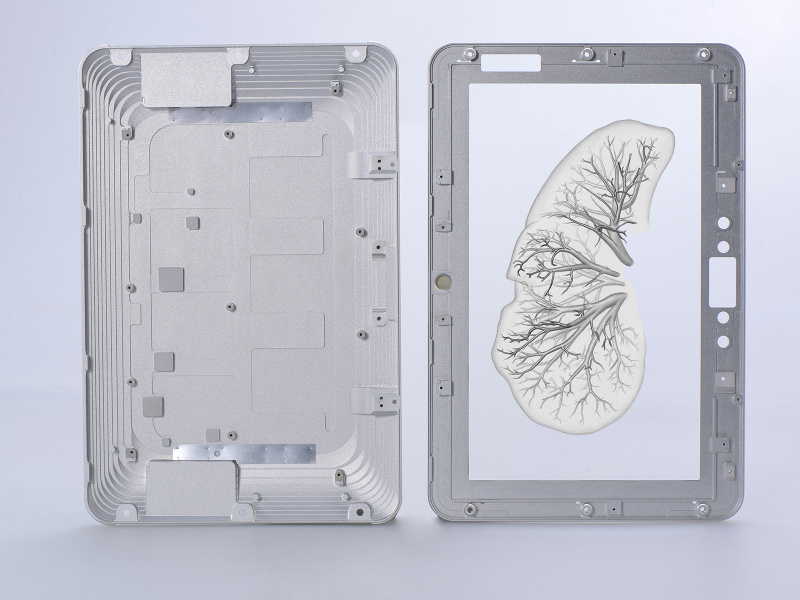 Collage: Die Darstellung einer Lungenhälfte in einem Chipgehäuse